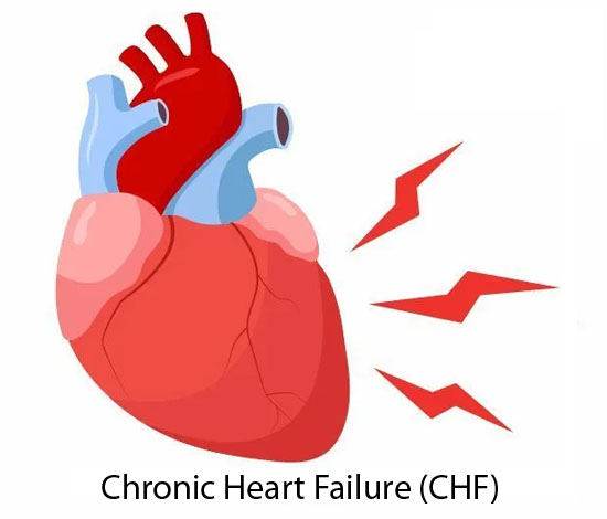 Chronic Heart Failure treatment in pune,india